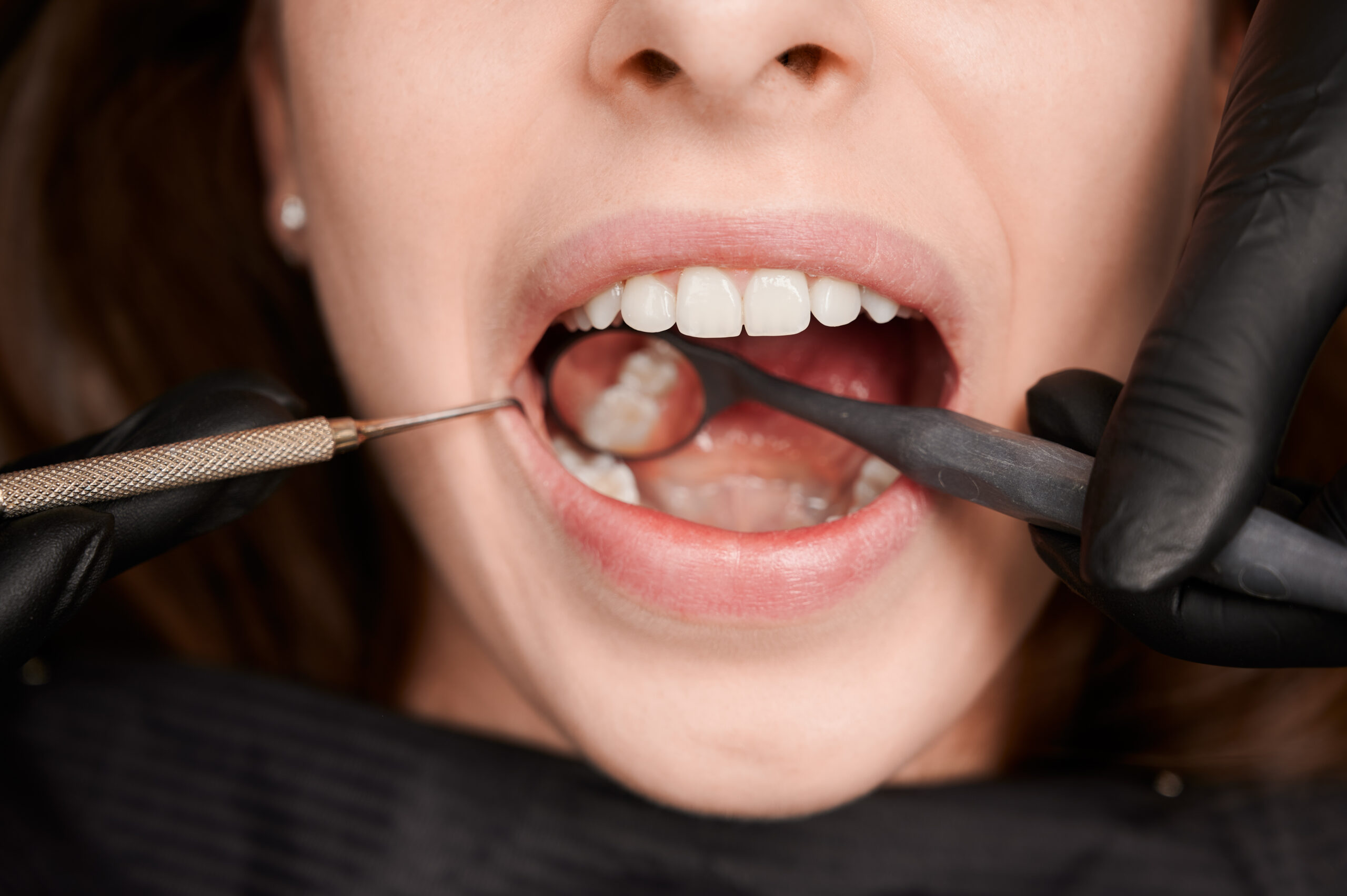Огляд зубів – Стоматологія Dental Solutions